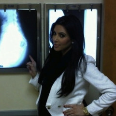 GofG Exclusive: Plastic Surgeon Weighs In On The Kim Kardashian Ass X-Ray